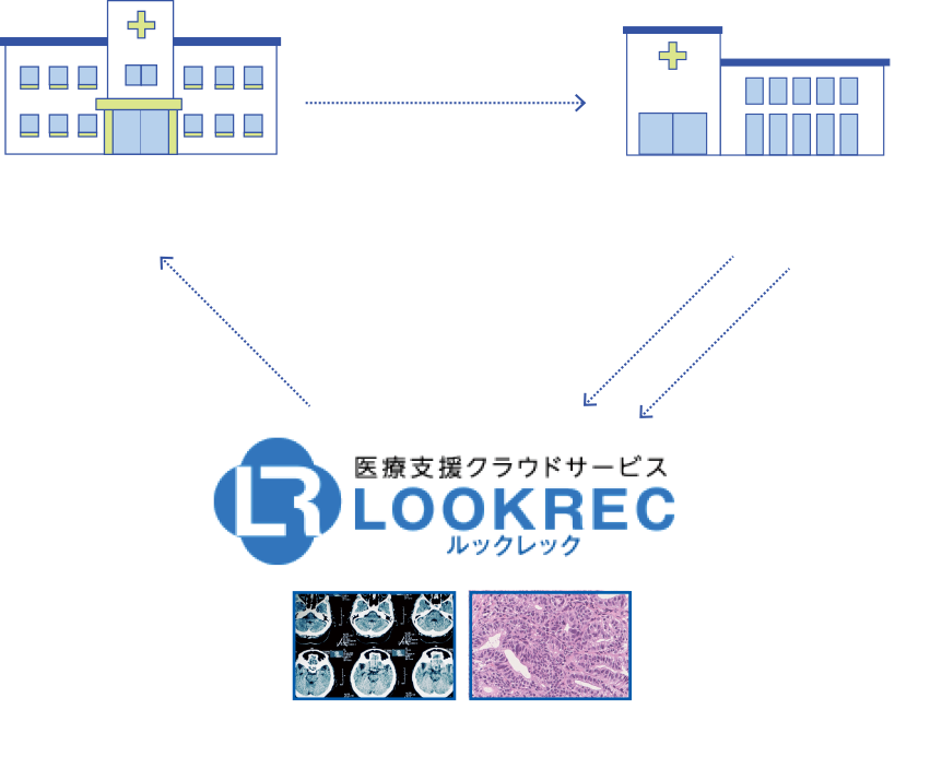 LOOKRECを使用した連携病理診断の流れ