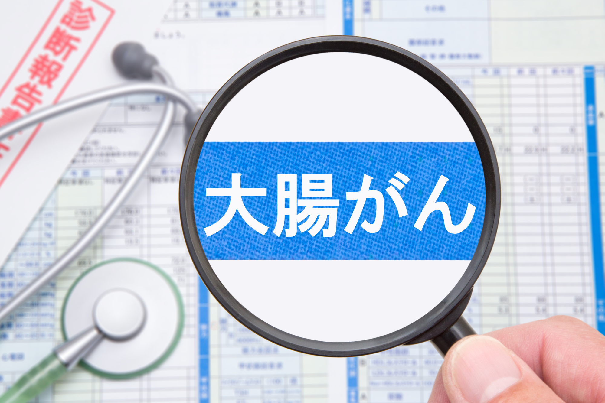 【大腸ポリープの病理学的検査】大腸がん診断の流れ